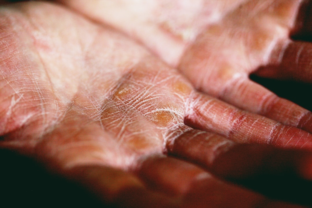 persons palm in close up photography