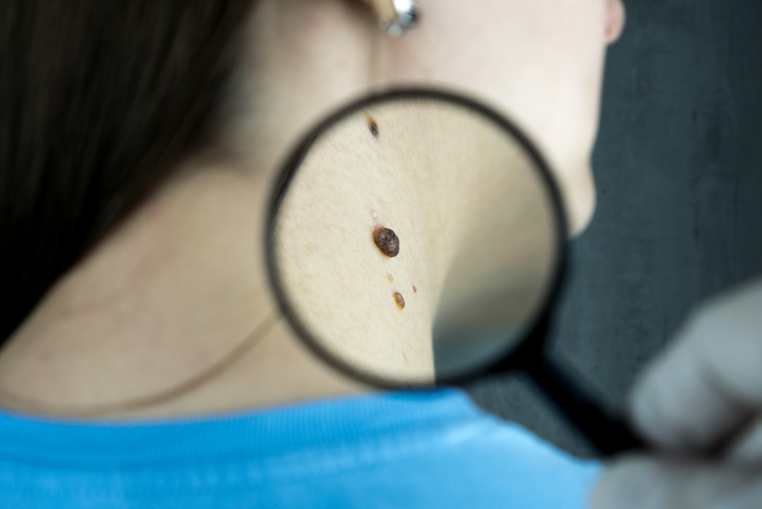 woman doing liposuction on her face